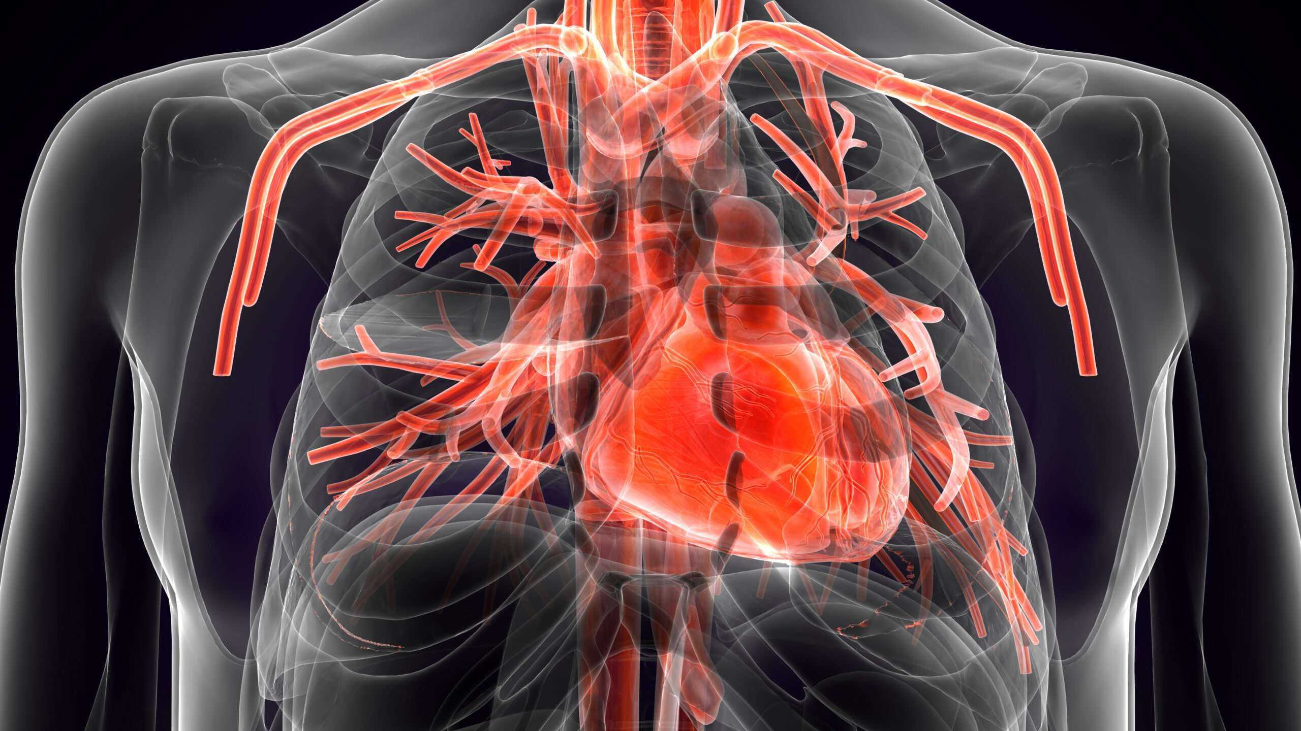 Common causes of heart disease