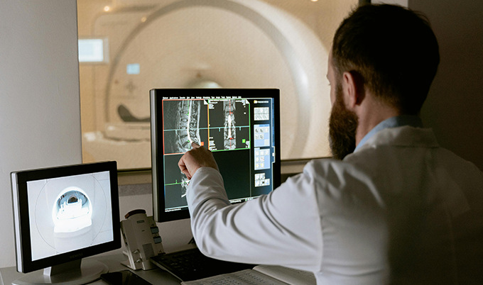 Technician reviewing a body scan to identify signs of microvascular ischemic disease