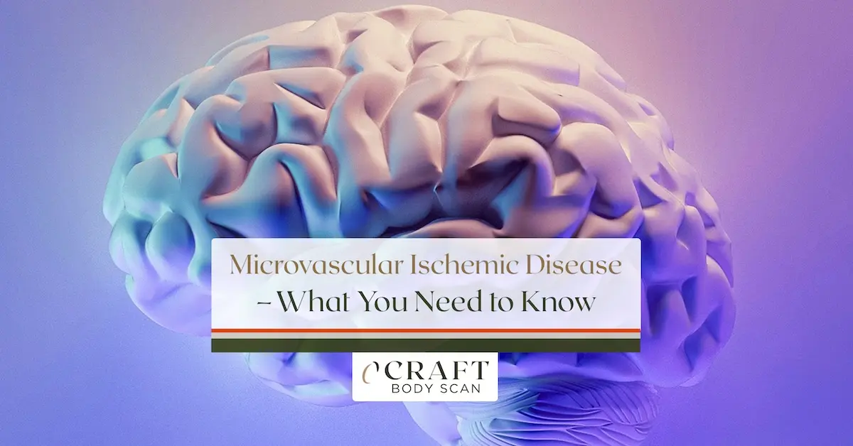 Microvascular ischemic disease: signs, symptoms, and preventative care