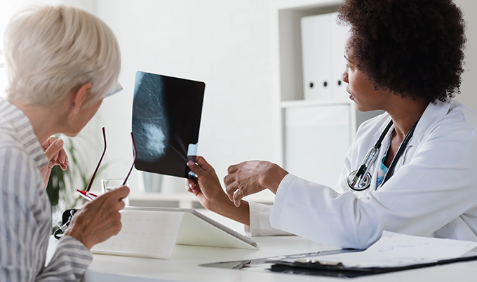 Timeline showing benefits of early cancer detection through regular screening