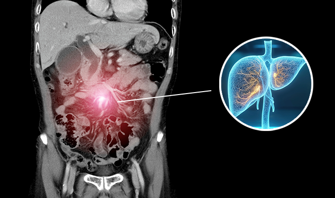The First Sign of Liver Cancer: What You Need to Know Before It's Too Late - Craft Body Scan
