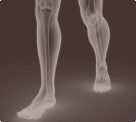 Digital X-ray style illustration showing the lower limbs, highlighting the bones, joints, and skeletal structure of the human legs.
